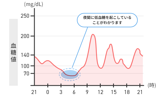 睡眠中の血糖値の推移がわかる